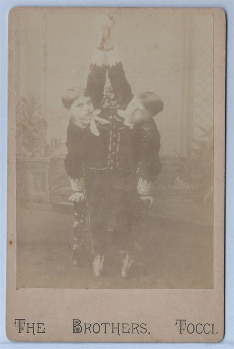 Circus Sideshow Freak Cabinet Card Photo Tocci Brothers Conjoined Siamese Twins