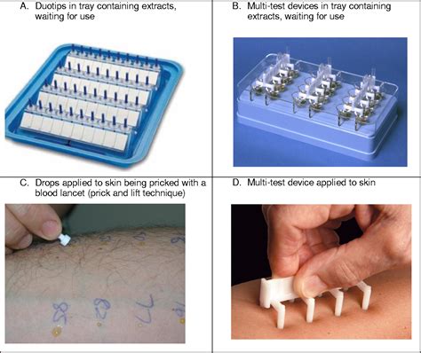 Figure 32 From Skin Prick Testing For The Diagnosis Of Allergic