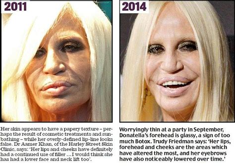 How Donatella Versace Transformed Herself Into A Human Waxwork