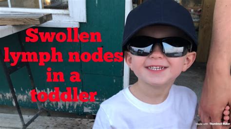 Swollen Lymph Nodes In A Toddler And When To Worry Youtube
