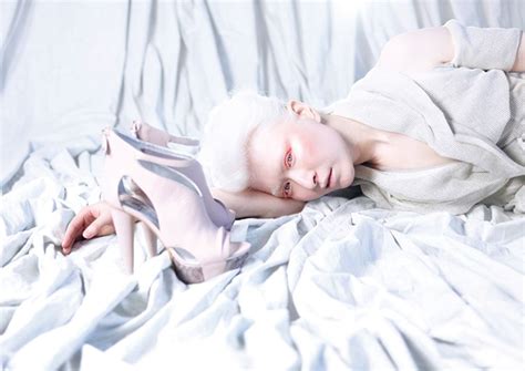 connie chiu is the first albino chinese model with blue eyes and naturally white blonde hair