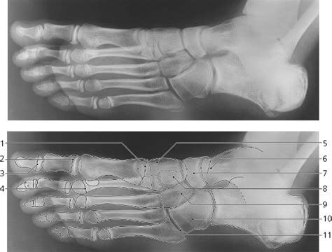 And Foot Radiology Key Free Download Nude Photo Gallery