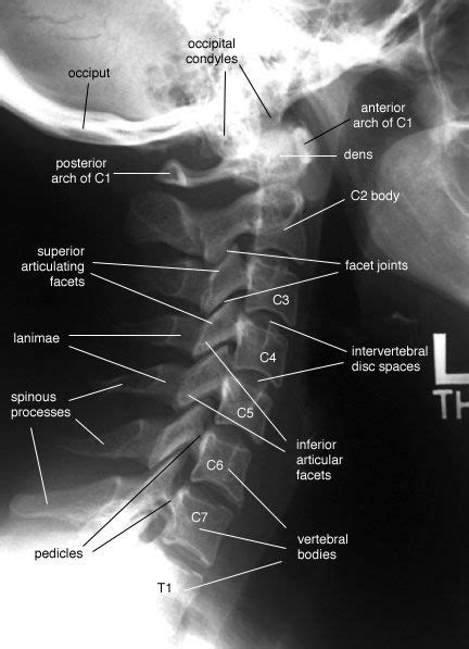 Radiographic Anatomy Of The Skeleton Cervical Spine