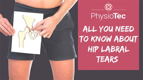 All you need to know about Hip Labral Tears An Tâm