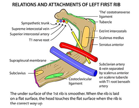 The influences of rib fracture displacement and collapse on the thoracic volume in the it may be associated with other lesions in body organs especially cardiac anomalies. Instant Anatomy - Thorax - Areas/Organs - Ribs - First rib