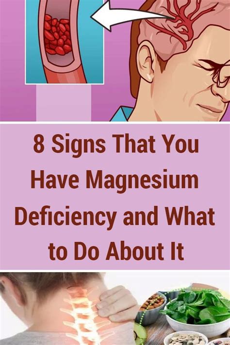 8 signs that you have magnesium deficiency and what to do about it Здоровье и благополучие