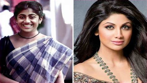 Bollywood Celebrity Plastic Surgery Before And After Celebrity Plastic Surgery Before An
