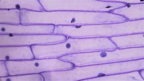 Onion Cell Under Microscope Leandroknoemorrison