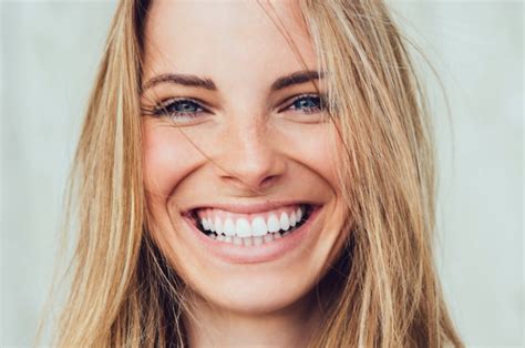 What Are The Pros And Cons Of Veneers North Sydney Dentistry