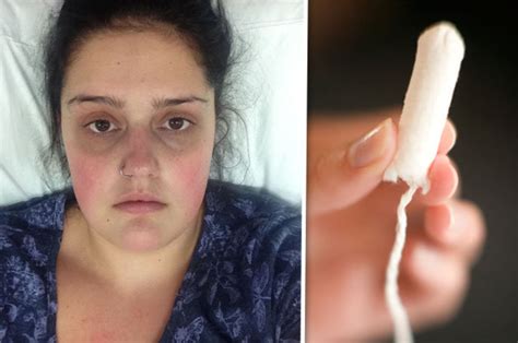 Student Left Seriously Ill After Leaving Tampon In For Nine Days Until