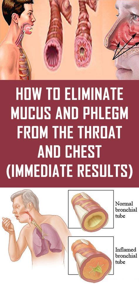How To Eliminate Mucus And Phlegm From The Throat And Chest Immediate