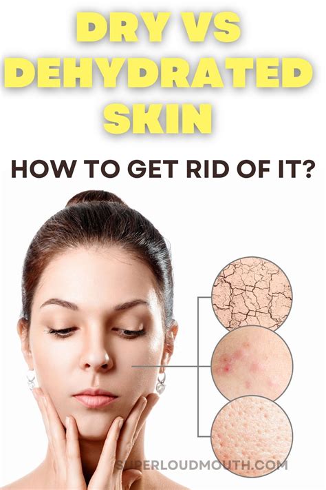 Dry Or Dehydrated Skin Effective Methods For Eliminating It Great
