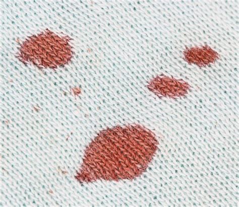Bei ganz frischen flecken reicht es oft aus, sie mit klarem, kaltem wasser abzutupfen. Eingetrocknete Blutflecken problemlos entfernen | Frag ...
