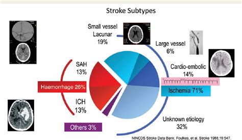 Pdf Secondary Prevention By Stroke Subtype Impact Of The Korean Experience Semantic Scholar