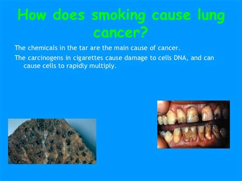 Future research needs to focus on this relationship in order to further explore the prognostic value of. Smoking & Cancer PPT