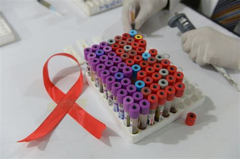 Cura AIDS Basta Un Iniezione Al Mese Arriva In Italia Il Trattamento