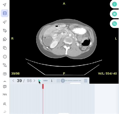 Convert Images And Dicom Slices Into Videos And Dicom Series