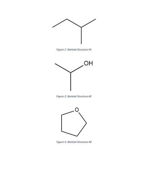 Solved Draw The Following Skeletal Structures Imaged Above As Lewis