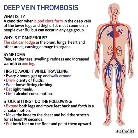 What Is Deep Vein Thrombosis What Are Its Symptoms Heart Health