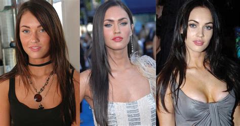 Megan Fox Plastic Surgery Before And After Pictures 2020