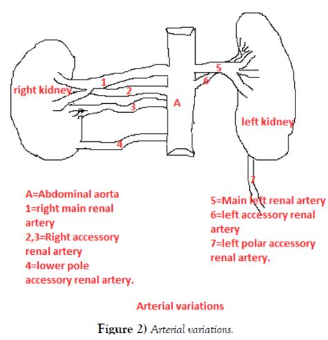 Variations In Vasculatures Of Kidney A Case Report