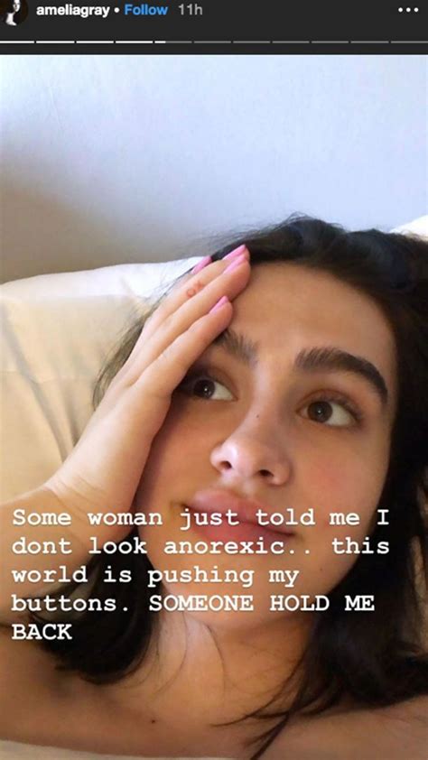 Lisa Rinnas Daughter Amelia Gets Real About Anorexia Battle Us Weekly