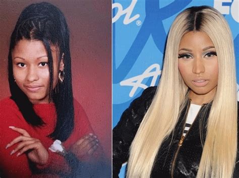Nicki Minaj Before And After Plastic Surgery Ass Implants Boobs