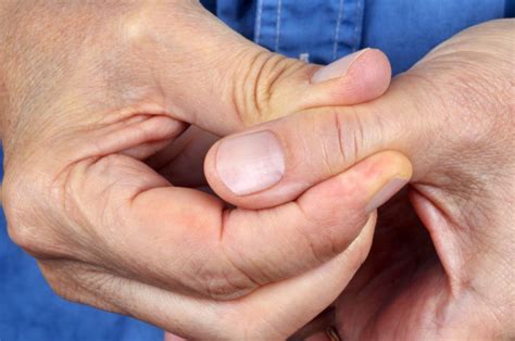 Treatment For Thumb Arthritis When To Consider Carpometacarpal Cmc