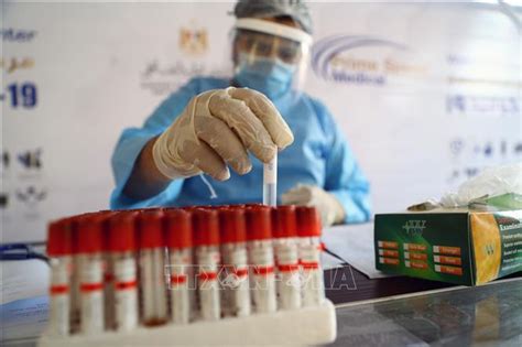 Anh ghi nhận số ca nhiễm mới cao nhất châu lục này (758 ca), tiếp sau là tây ban nha (530. Thông tấn xã Việt Nam (TTXVN)