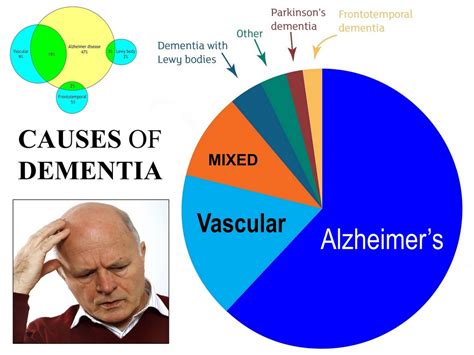 Dementia Caused By Parkinsons Disease Alzheimers Disease Causes