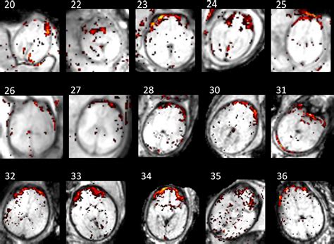 The Brain Before Birth Using Fmri To Explore The Secrets Of Fetal