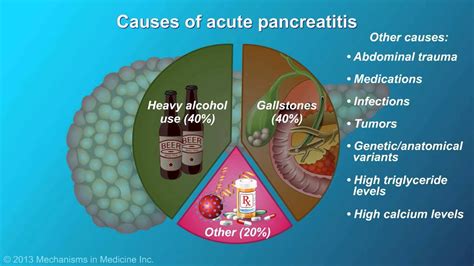 Keith Siau On Twitter Causes Of Acute Pancreatitis Meded Https T