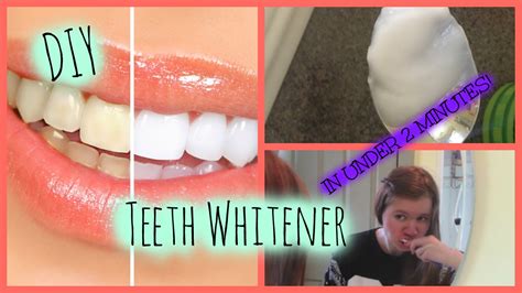How To Whiten Your Teeth In 2 Minutes Super Easy Diy Teeth Whitener