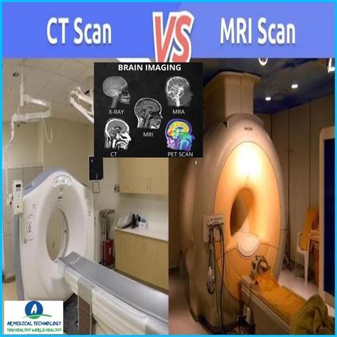 CT Scan Vs MRI What S The Difference Best Benefits And Risks 23