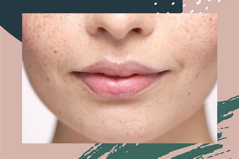 Such kitchen ingredients that are easily available can make effective hair removal solutions that contain extensive bleaching properties. Upper Lip Hair Removal: How To Wax Your Upper Lip At Home ...