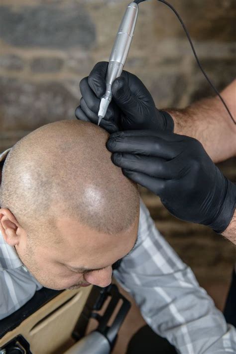 Definitely yes, since any almost bald haircut minimizes most of the risks and looks good no matter how thin your hair is. Hair tattoos for balding men. | Thick hair remedies, Hair ...