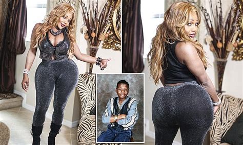 transgender woman has had more than a hundred black market silicone injections in her bum