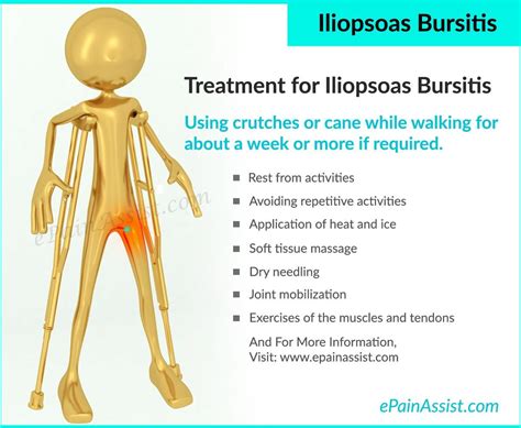 Iliopsoas Bursitis Treatment Exercise Causes Symptoms Risk Factors