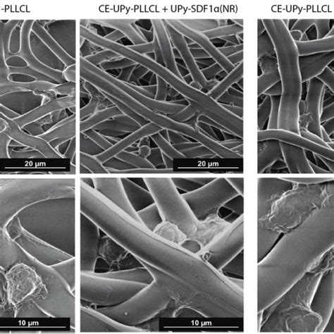 Scanning Electron Microscopy Of Fibers After Blood Cells Were Allowed