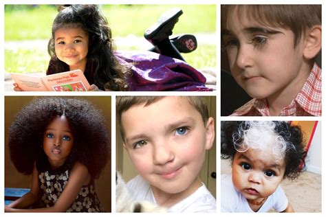 Top 10 Unusual Kids Around The World Kids With Unique Features In 2020