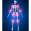 Joint Pain And Inflammation Do You Need Arthritis Relief 
