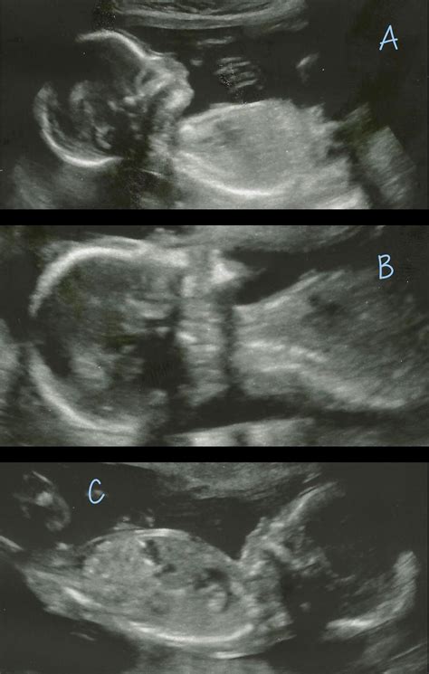 Two And Triplets May 2013