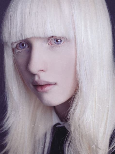 Nastya By Kumarov Amkote Michael Px Albino Model Albino Girl