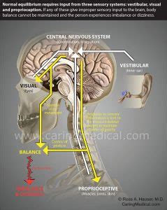 When persistent post-concussion syndrome turns into a neurologic