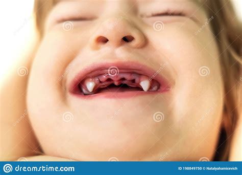 Dentistry Close Up Of A Beautiful Little Girl Lying Down And Showing