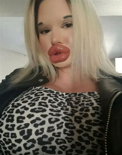 Woman With Biggest Lips In World Has Many Fans Offering To Fly Her On Holiday Best Travel Tale