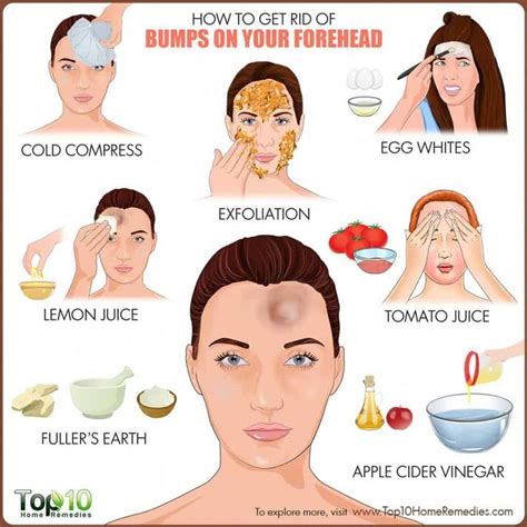 How To Get Rid Of Bumps On Forehead Top 10 Home Remedies Skincare