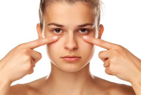 Under Eye Bags Causes And Treatment Options Emedihealth
