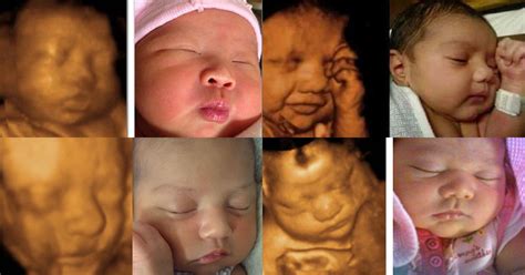 3d And 4d Pregnancy Scans The Perfect Way To Say Hello To Your Baby