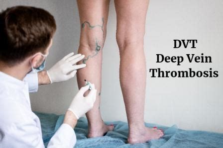 Deep Vein Thrombosis Dvt Treatments In Pune Dr Abhijeet Gotkhinde